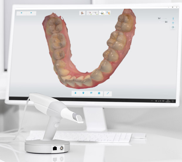 San Marcos 3D Cone Beam and 3D Dental Scans