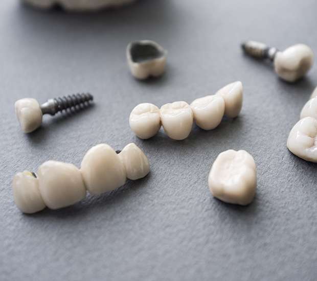 San Marcos The Difference Between Dental Implants and Mini Dental Implants