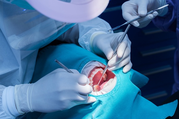 When Is Oral Surgery Necessary? Common Procedures Explained