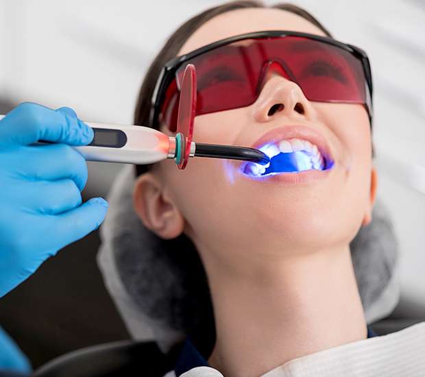 San Marcos Professional Teeth Whitening