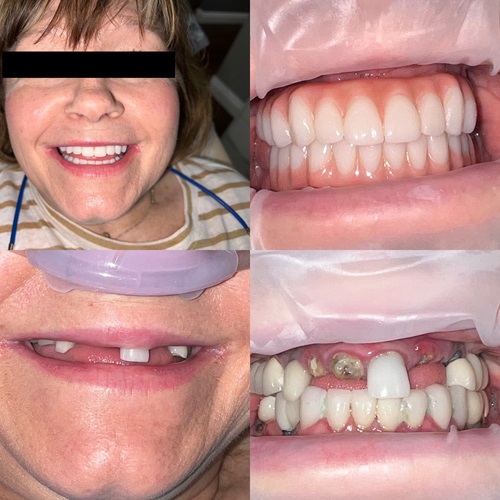 smile-9